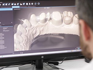 3D Modelling In Our Dental Laboratory