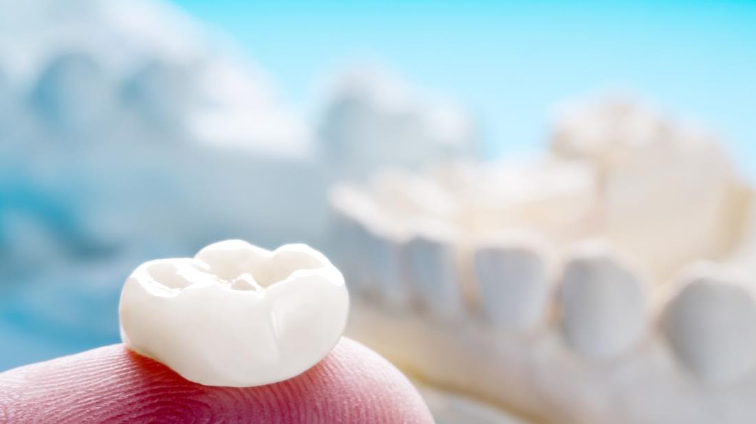 Dental Crowns in Turkey