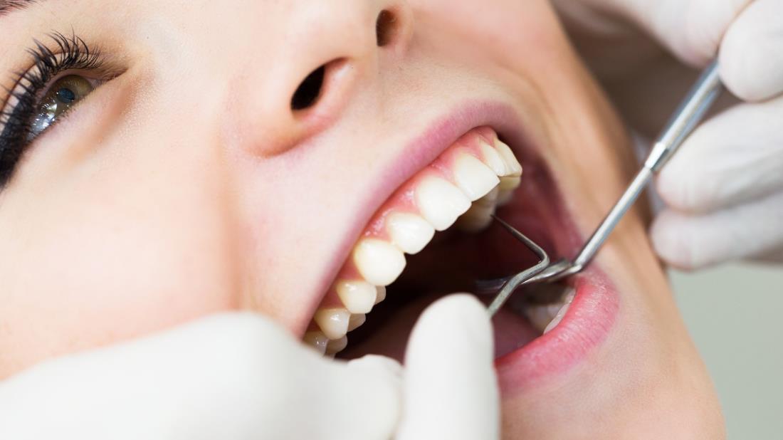 Root Canal Treatment in Turkey